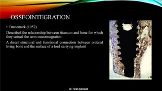 Basic dental implant