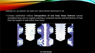 Basic dental implant