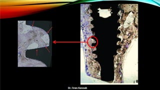 Basic dental implant
