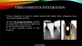 Basic dental implant