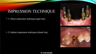 Basic dental implant