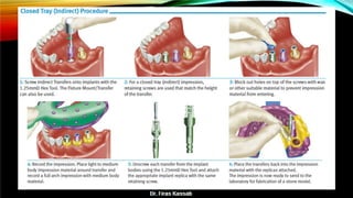 Basic dental implant