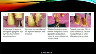 Basic dental implant