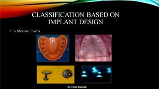 Basic dental implant