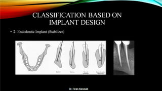 Basic dental implant