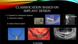 Basic dental implant