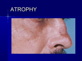 Basic dermatology by Dr. Haseeb Ahmed | PPT