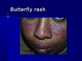 Basic dermatology by Dr. Haseeb Ahmed | PPT