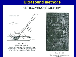Ultrasound methods
 