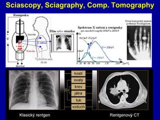 Sciascopy, Sciagraphy, Comp. Tomography
 