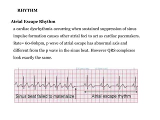 Basic ecg | PPTX