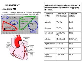 Localizing Mi Basic ecg | PPTX