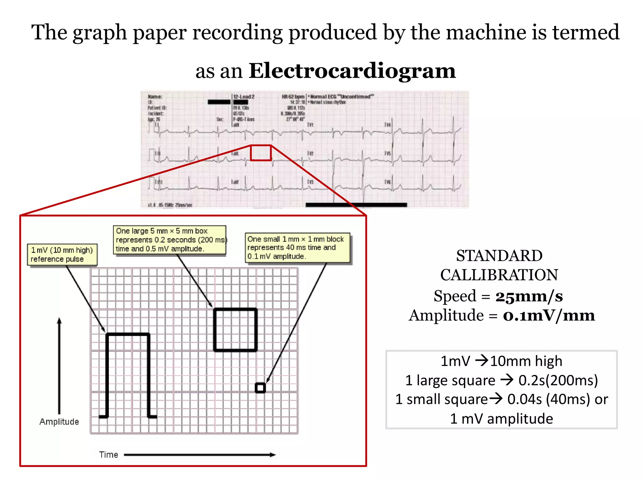 Basic ecg | PPTX