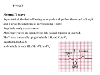 Normal T Wave Parameters Basic ecg | PPTX