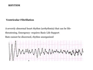 Basic ecg | PPTX