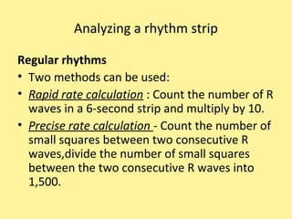 Rhythym Calculation Using 1500 Method Basic ECG | PPT