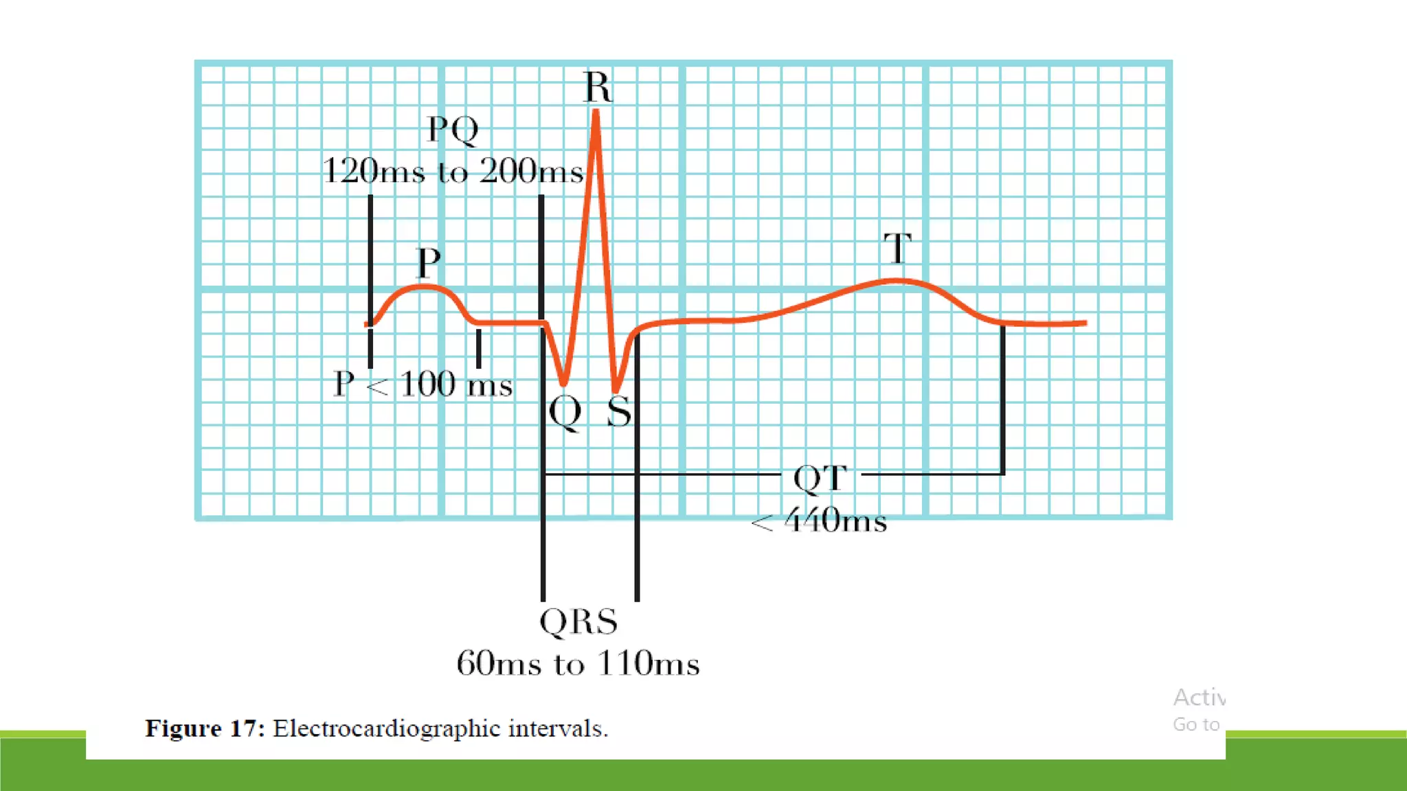 Basic ecg | PPTX