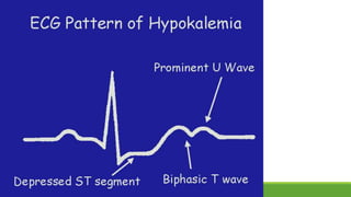 Basic ecg | PPTX