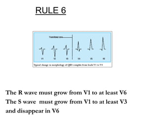 Basic ecg | PPT