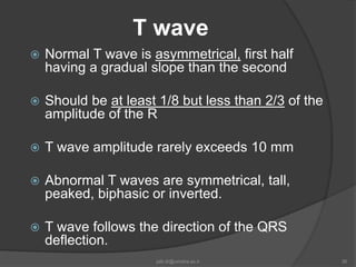 Normal T Wave Value Basic ecg1 | PPTX