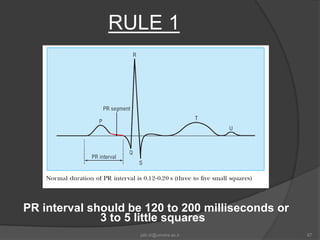 Pr Interval Ruler Basic ecg1 | PPTX