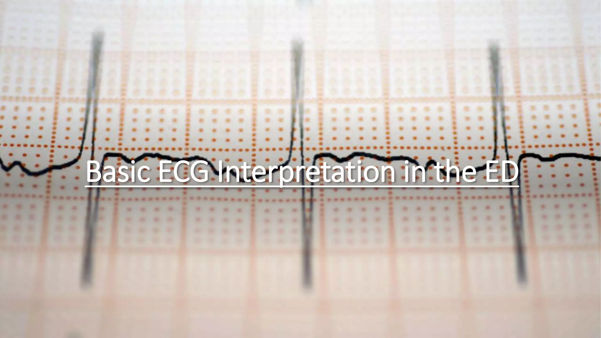 Basic ECG Interpretation.pptx