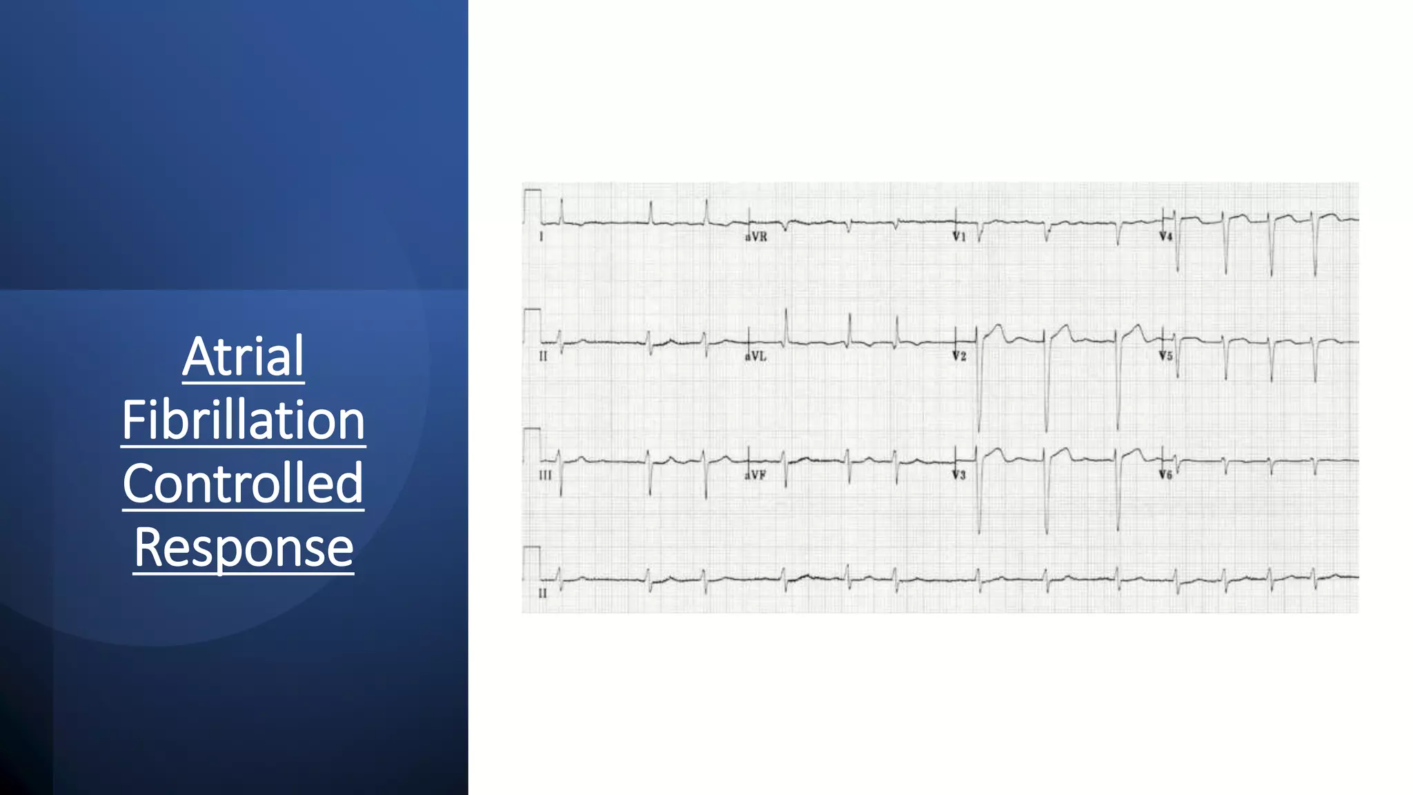 Basic ECG Interpretation.pptx