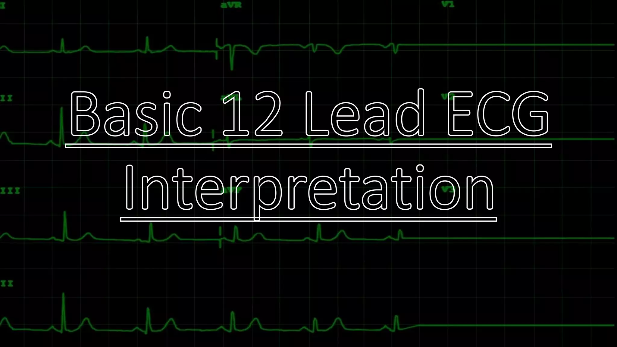 Basic ECG Interpretation.pptx