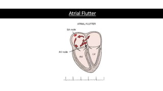 Basic ECG Interpretation.pptx
