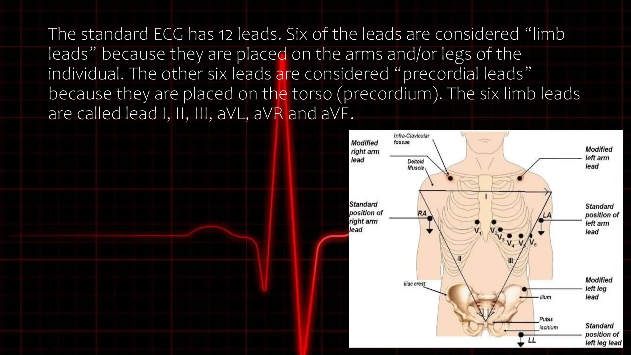 BASIC ECG INTERPRETATION.pptx | Heart and Cardiovascular Diseases ...