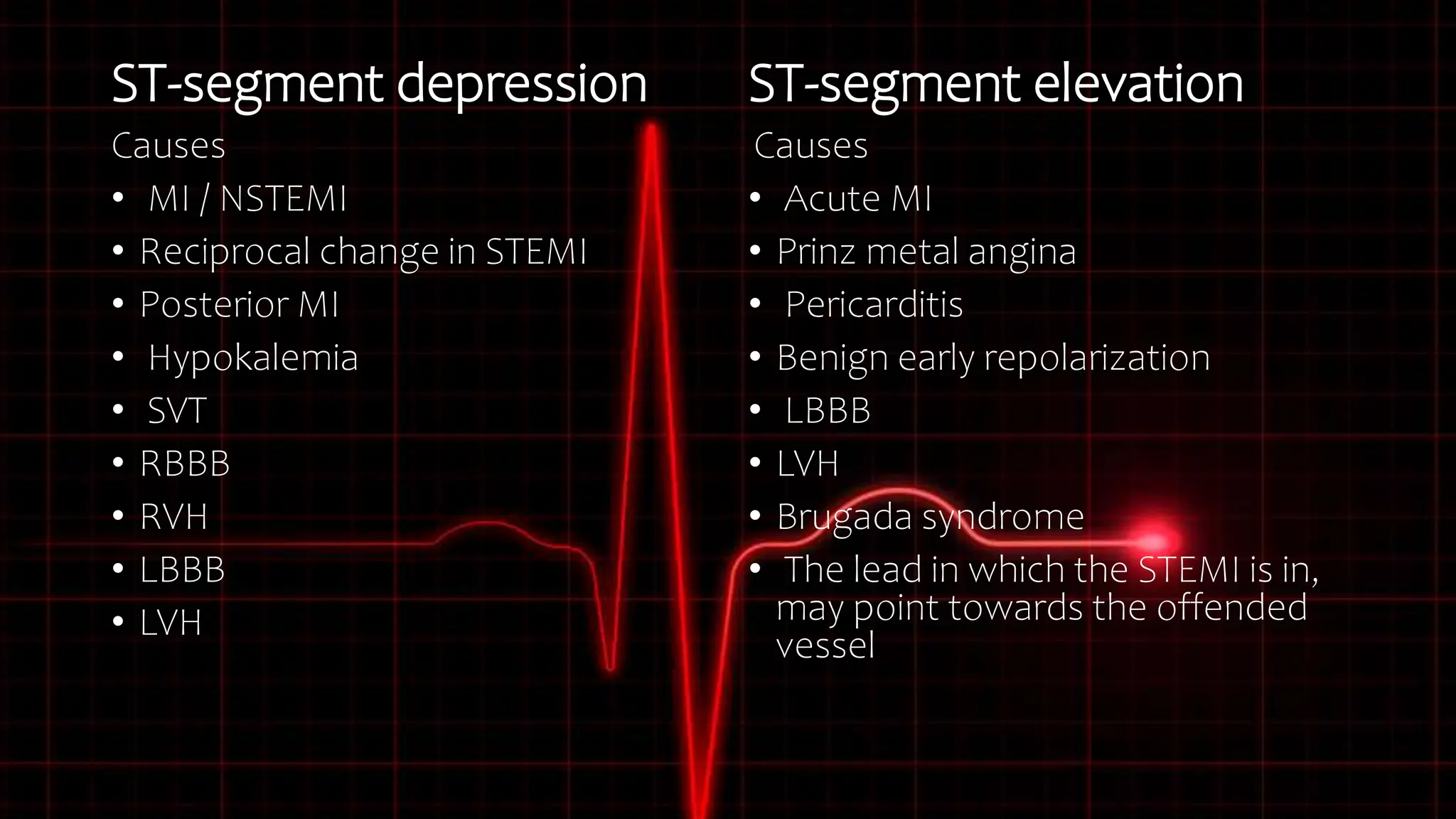 Svt Depression BASIC ECG INTERPRETATION.pptx