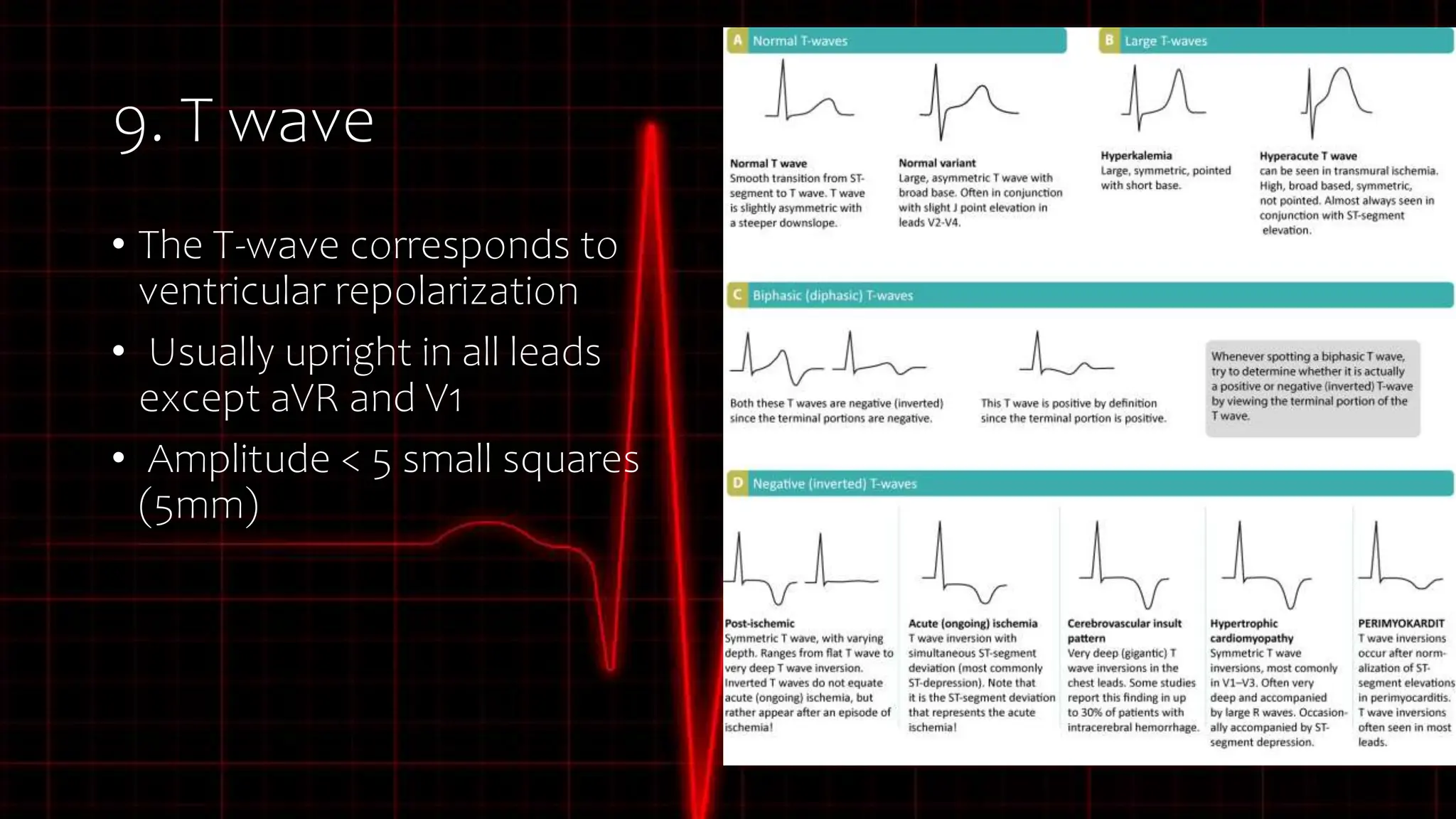 BASIC ECG INTERPRETATION.pptx