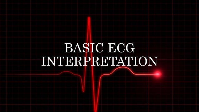 BASIC ECG INTERPRETATION.pptx