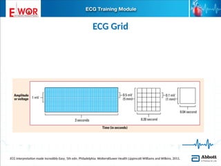 Basic ECG interpretation.pptx learn about ecg | PPTX
