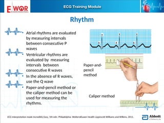Two Consecutive R Waves Basic ECG interpretation.pptx learn about ecg | PPTX