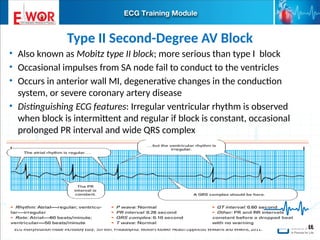 Basic ECG interpretation.pptx learn about ecg | PPTX