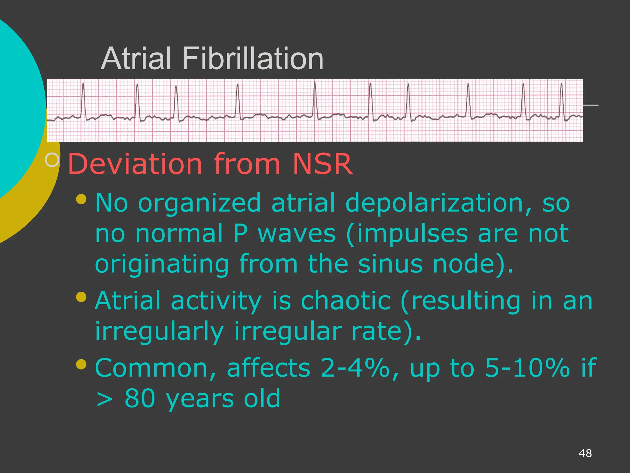 Basic ECG Interrpretation Online Course.ppt