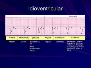 BASIC ECG RTHYM RAJI.pptx ACLS PREPARATION | PPTX