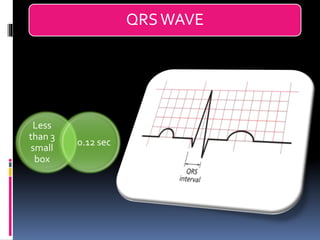 Basic ECG &rhythm interpretation | PDF