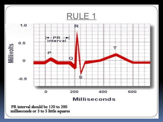 Basic ECG &rhythm interpretation | PDF