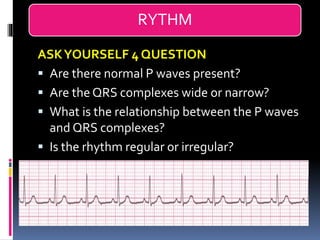 Regular Rythm Engineering Basic ECG &rhythm interpretation | PDF