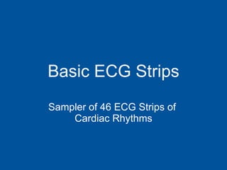 Basic ECG Strips Sampler of 46 ECG Strips of  Cardiac Rhythms 