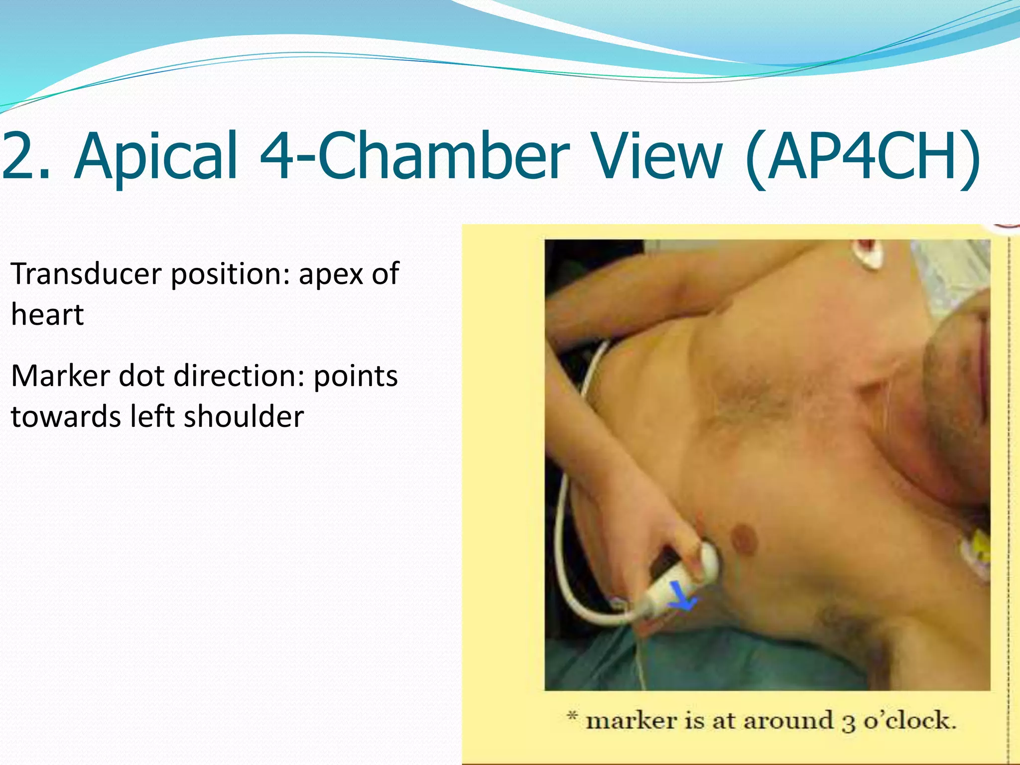 Basic echocardiography | PPTX