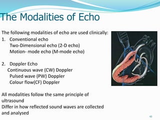 Basic echocardiography | PPTX