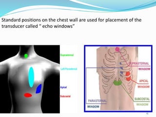 15
Standard positions on the chest wall are used for placement of the
transducer called “ echo windows”
 