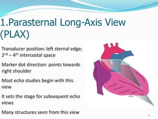 1.Parasternal Long-Axis View
(PLAX)
17
Transducer position: left sternal edge;
2nd – 4th intercostal space
Marker dot direction: points towards
right shoulder
Most echo studies begin with this
view
It sets the stage for subsequent echo
views
Many structures seen from this view
 