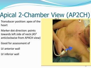 Apical 2-Chamber View (AP2CH)
35
Transducer position: apex of the
heart
Marker dot direction: points
towards left side of neck (450
anticlockwise from AP4CH view)
Good for assessment of
LV anterior wall
LV inferior wall
 