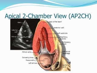 Apical 2-Chamber View (AP2CH)
 
