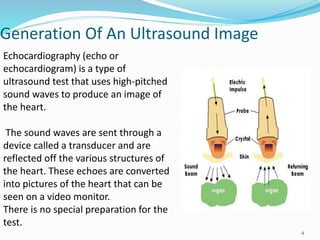 Generation Of An Ultrasound Image
4
Echocardiography (echo or
echocardiogram) is a type of
ultrasound test that uses high-pitched
sound waves to produce an image of
the heart.
The sound waves are sent through a
device called a transducer and are
reflected off the various structures of
the heart. These echoes are converted
into pictures of the heart that can be
seen on a video monitor.
There is no special preparation for the
test.
 