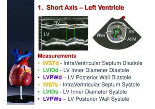 Basic Echocardiography | PDF